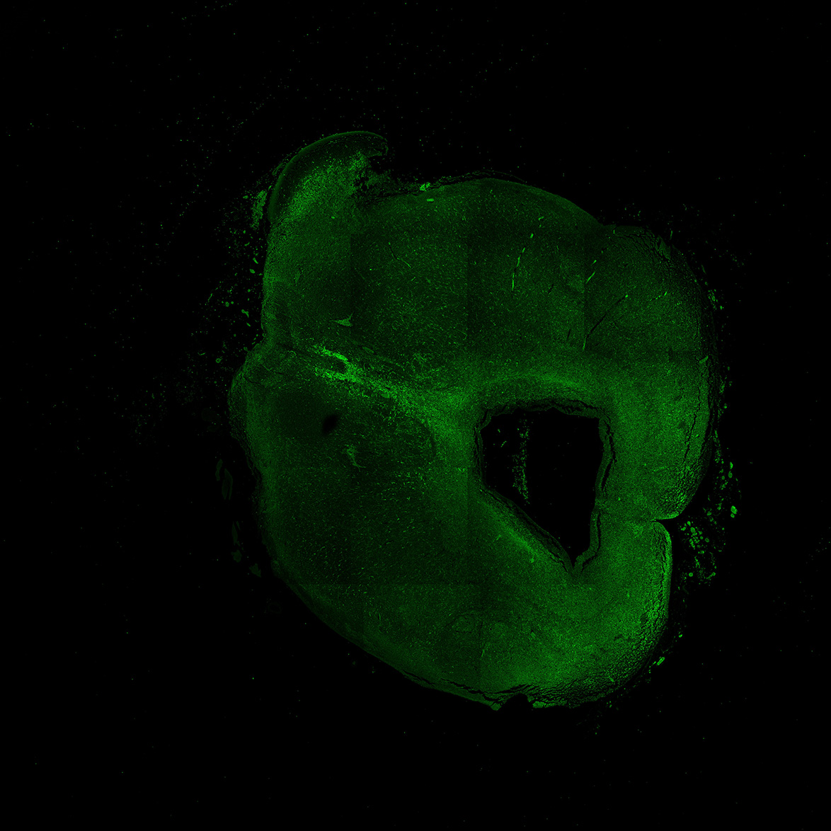 Human foetal midbrain